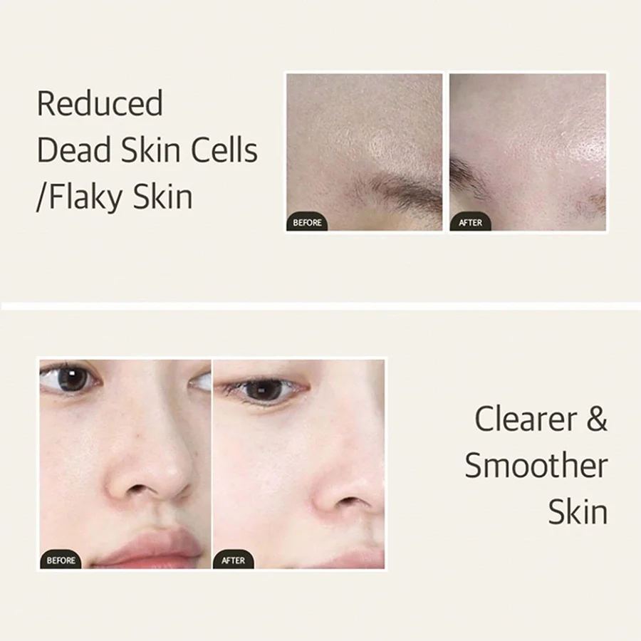 Mixsoon Bean Essence Korean Skin Care Serum - Exfoliating Hydrating Glass Skin Hyaluronic Acid for Moisturized Smooth Complexion